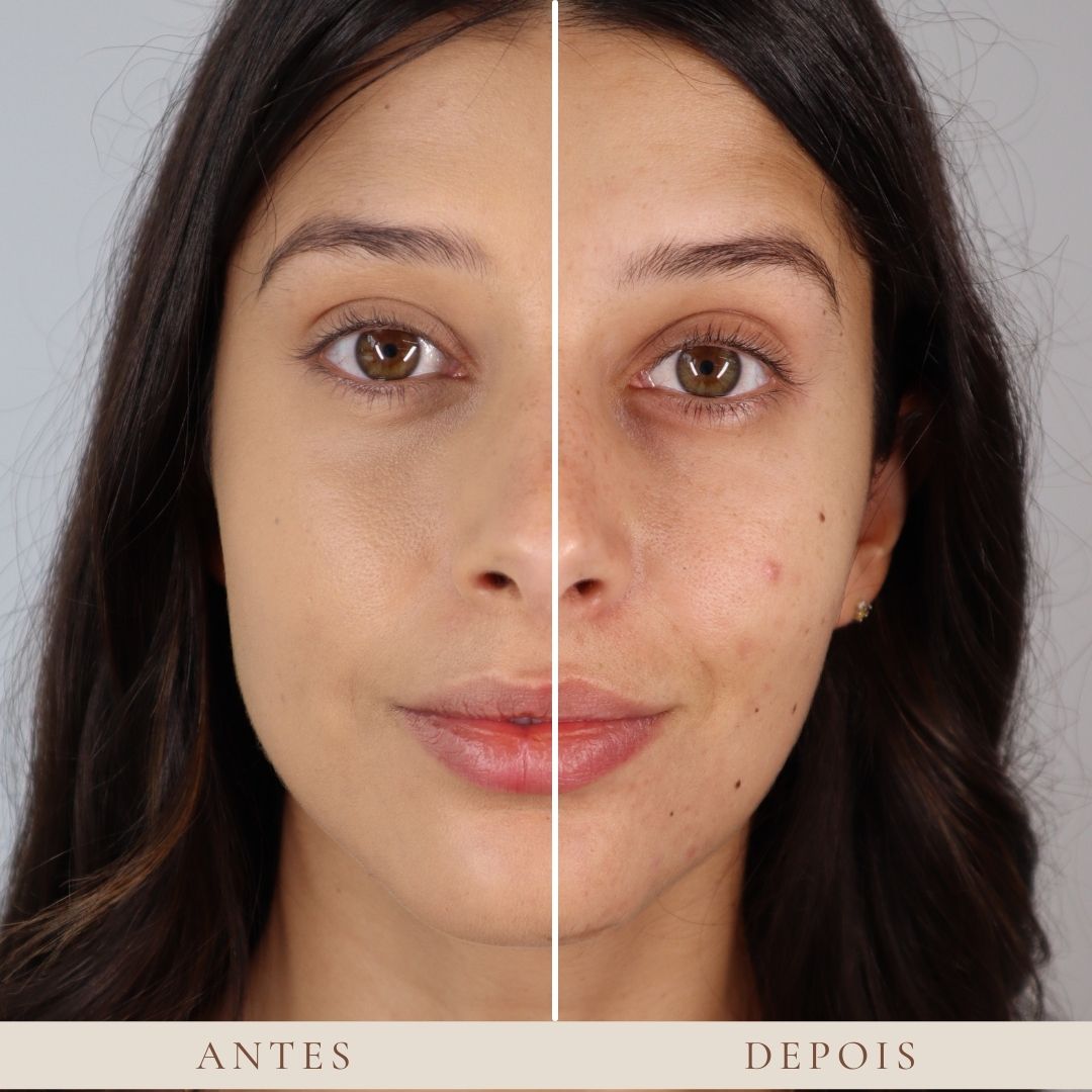 Maybelline Instant Anti-Age Eraser  6.8ml